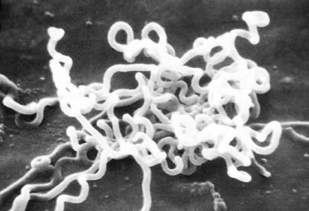 Treponema_pallidum.jpg